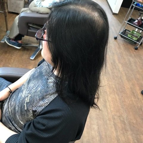 ヘアドネーション